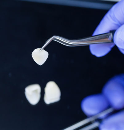 Dentist holding tooth-colored dental crown with tweezers, comparing with sample teeth on dark surface.