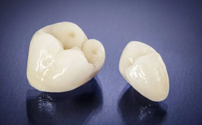 Two dental crowns displayed on dark surface, showing tooth-colored ceramic restorations.