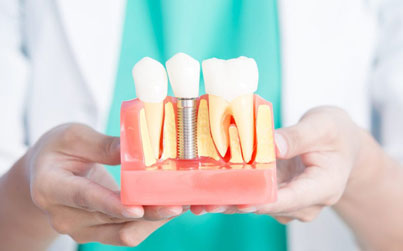 Dentist in teal scrubs holding dental implant model showing tooth structure and placement.