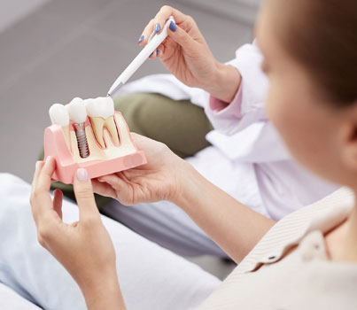 Dental professional showing patient tooth shade guide samples for color matching during consultation.