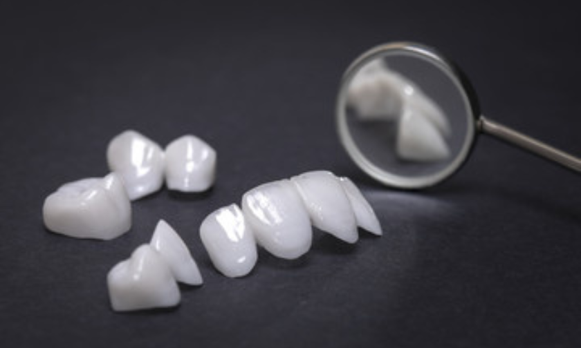 Featured image for “<strong>Porcelain Veneers or Crowns</strong>”