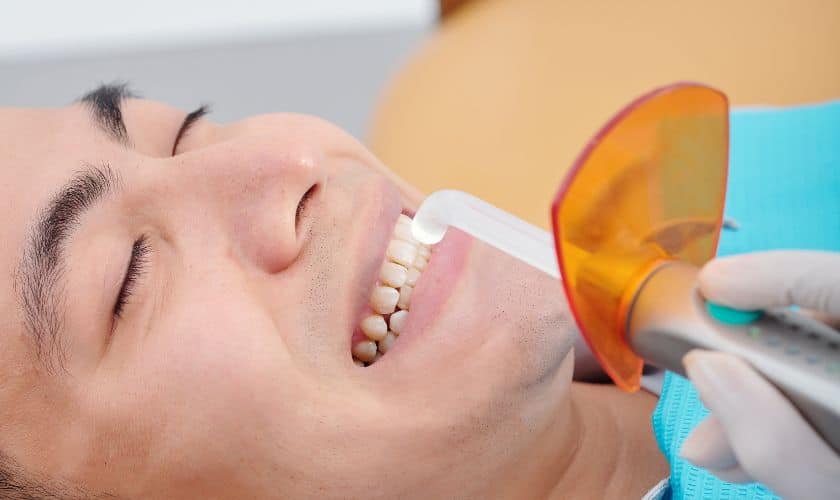 Featured image for “Revive Your Smile’s Radiance With Expert Composite Resin Fillings”