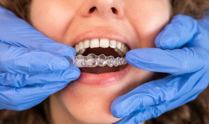 Featured image for “Elevate Your Confidence With Invisalign In Palm Desert”
