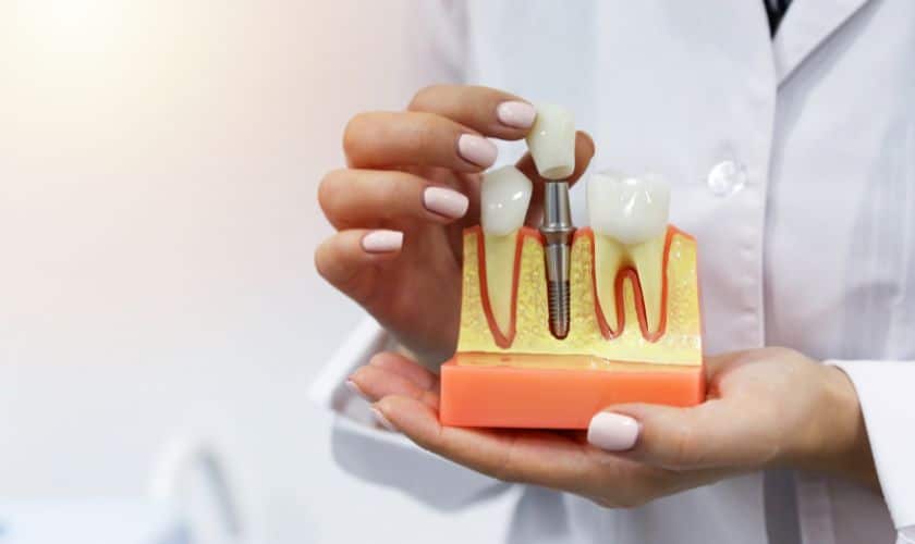 Dental Implant Procedures: What To Expect During Treatment