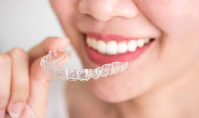 Featured image for “Can You Eat Normally with Invisalign? A Guide to Food & Aligners”