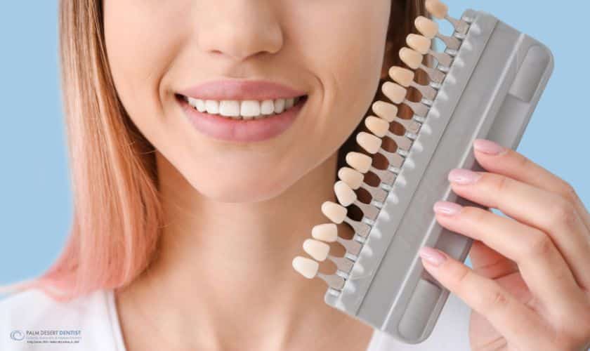 porcelain veneers palm desert