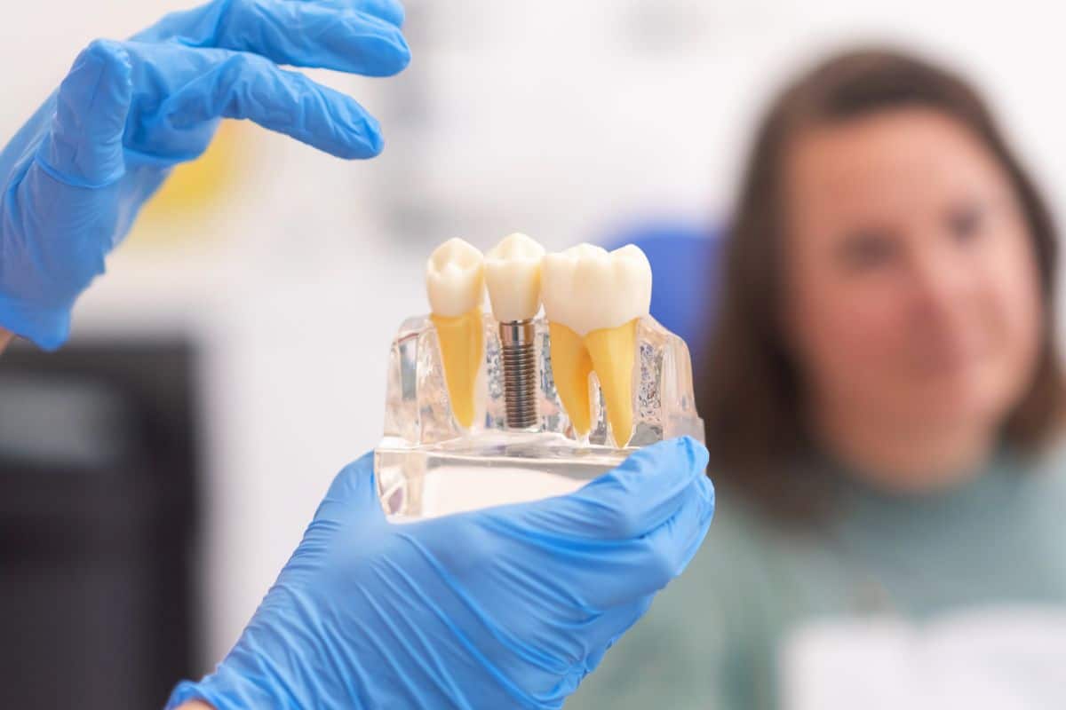 dental implants palm desert