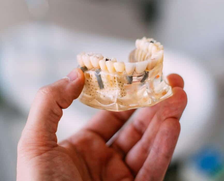 Hand holding clear dental aligner or retainer against blurred background