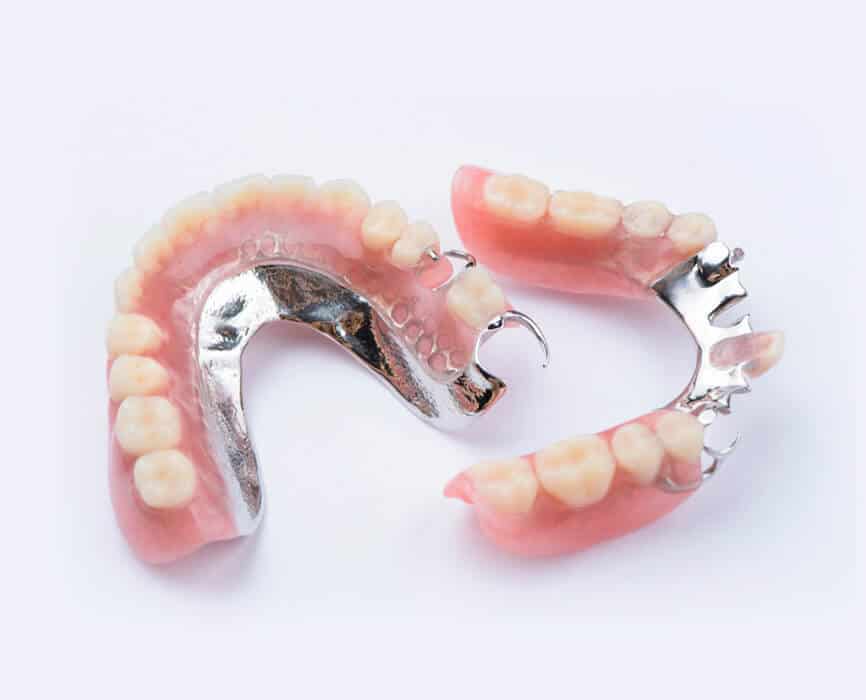 Partial dentures displayed showing artificial teeth attachments and metal clasps on white background.