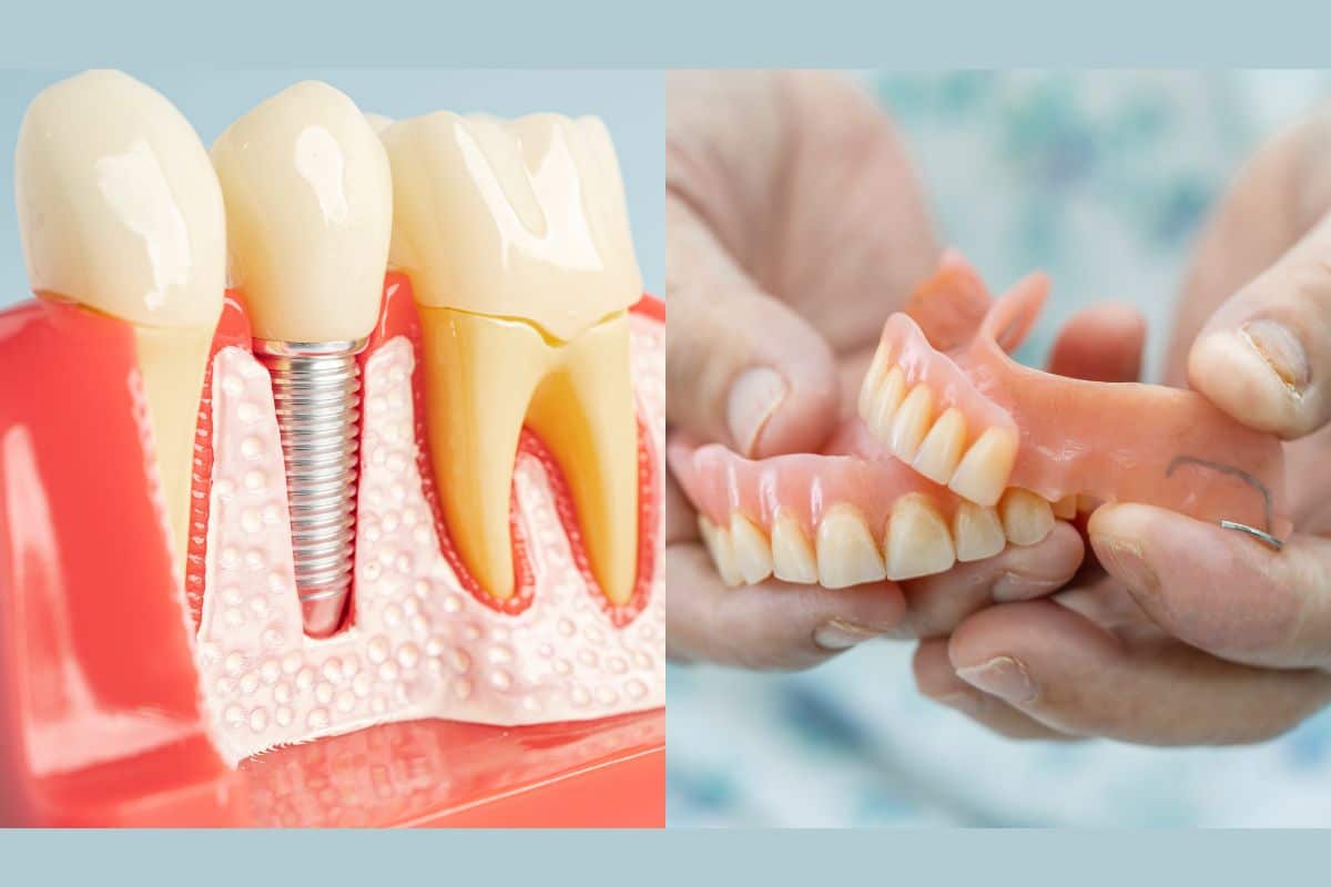 Featured image for “Should You Get Dental Implants or Dentures? A Palm Desert Dentist Explains”