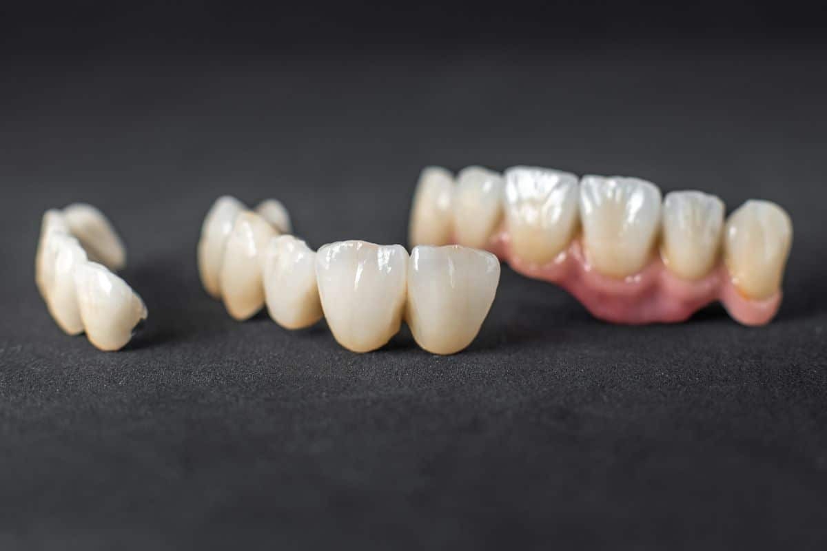 How to Care for Porcelain Crowns