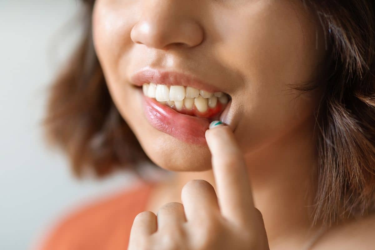 Featured image for “What to Do About a Dental Abscess or Swollen Face: Urgent Care Steps”