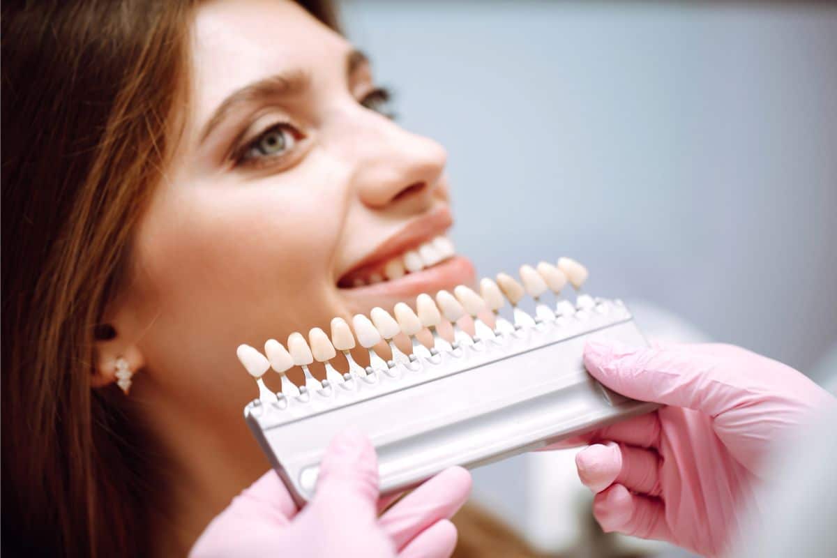 Featured image for “Should You Whiten Your Teeth Before Getting Veneers?”